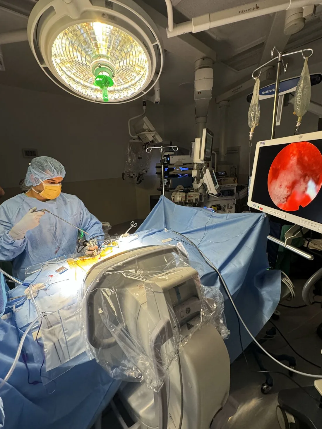 Endoscopic spinal fusion procedure