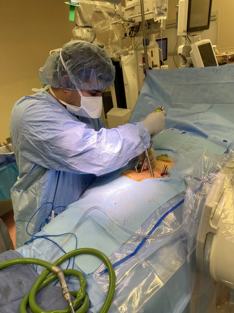 Minimally invasive pelvic screws for complex spinal trauma