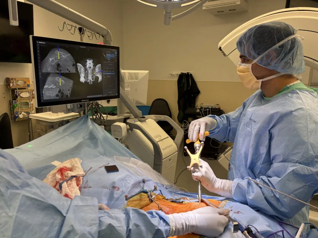 Minimally invasive SI joint fusion procedure